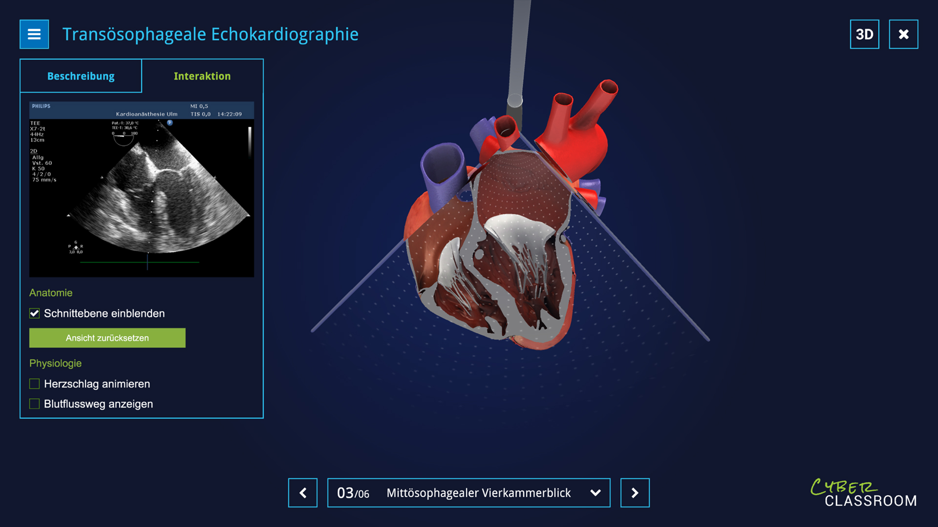 unity learning application of university of ulm heart virtual cutted